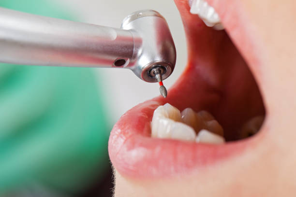 Best Emergency Treatment for Dental Infections or Abscesses in Elmore, OH